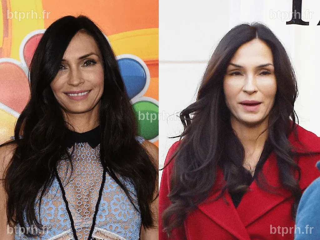 ¿Cómo la cirugía plástica de Famke Janssen la ayuda a parecer más joven ...