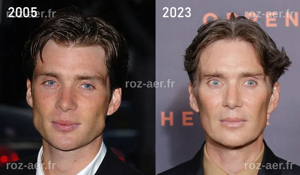 Cillian Murphy et la Chirurgie Esthétique : Vérités, Rumeurs et Réalités