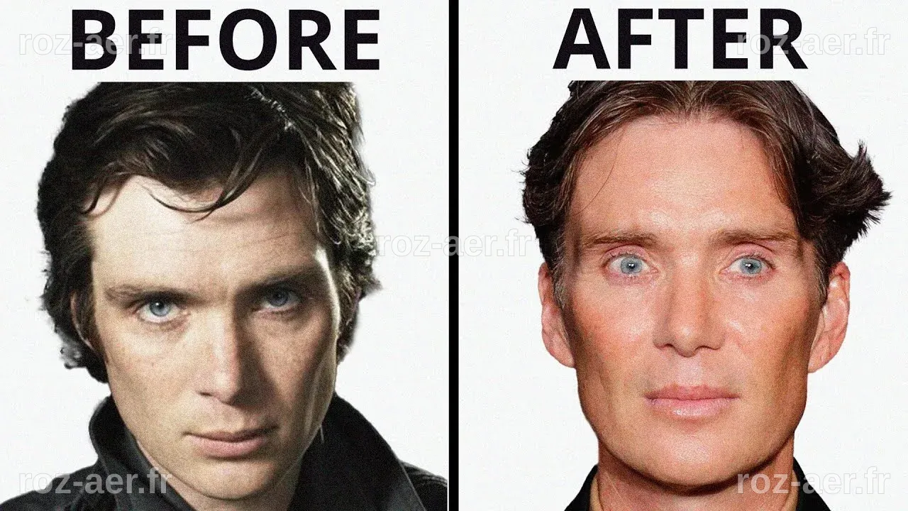 Cillian Murphy: All Natural? | Plastic Surgery Analysis - YouTube