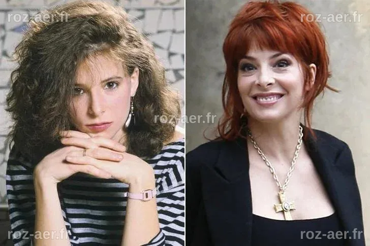 Mylene Farmer Chirurgie Esthétique