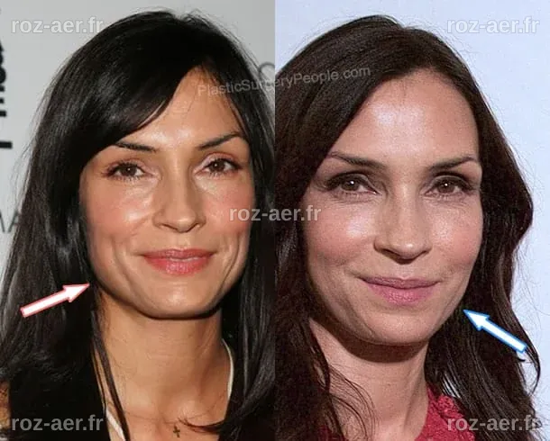 Famke Janssen: BEFORE and AFTER 2022
