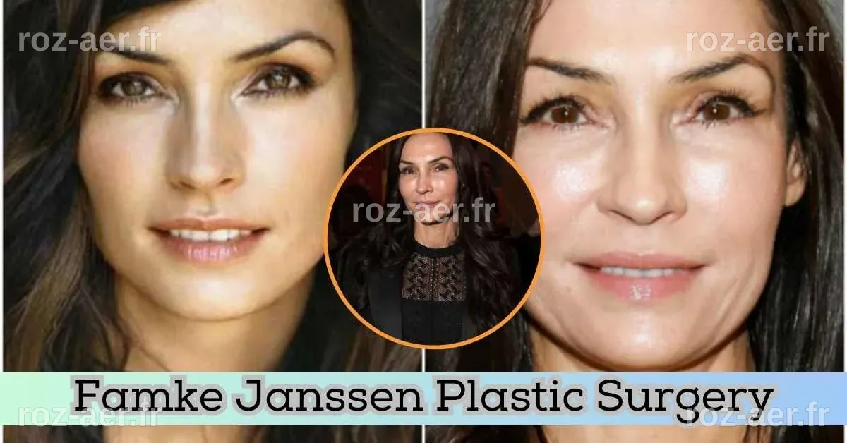 Famke Janssen Plastic Surgery: A Look At Her Transformation After And ...
