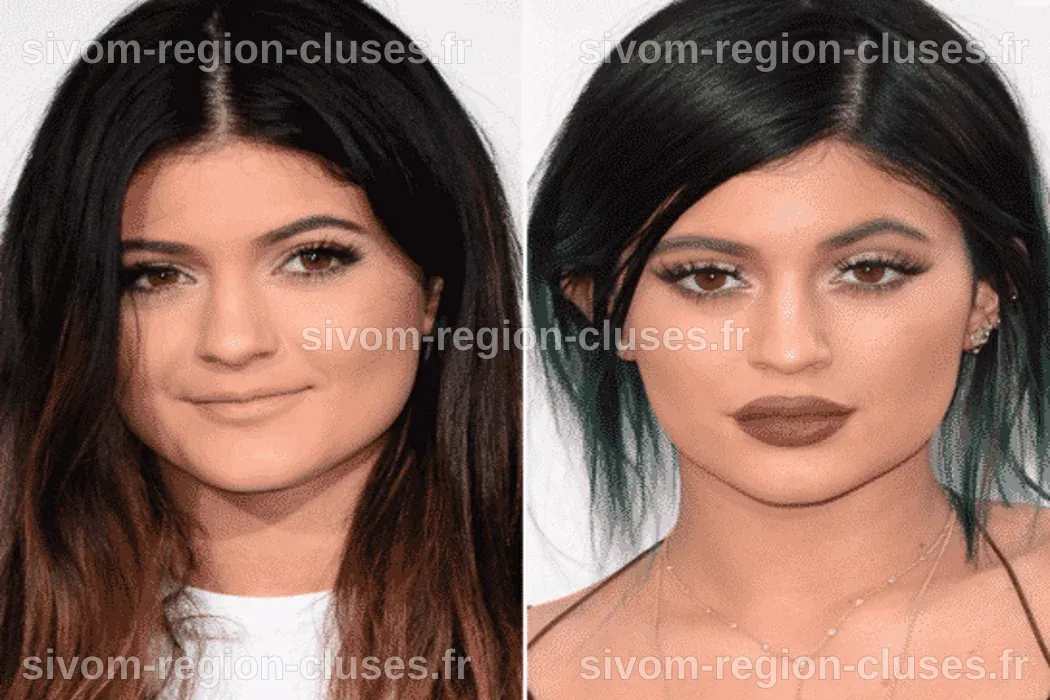 kylie jenner avant chirurgie et maintenant : L’évolution beauté
