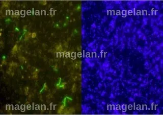 Quels sont ces microbes inconnus aux propriétés étonnantes découverts ...