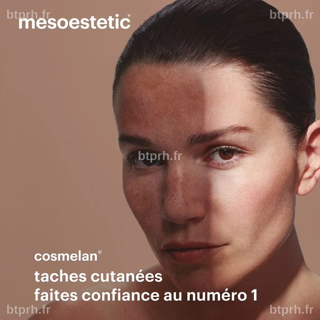 cosmelan® : leader mondial de la dépigmentation