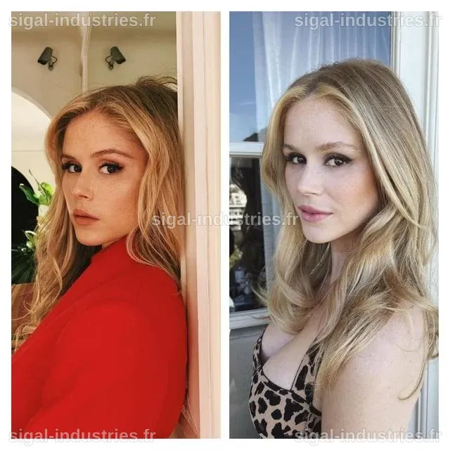Analyse de la chirurgie esthétique d'Erin Moriarty : Révélations et transformations