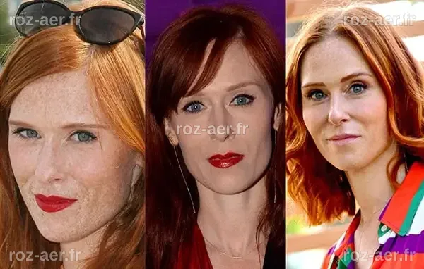 Audrey Fleurot : Mythes et Réalités sur la Chirurgie Esthétique