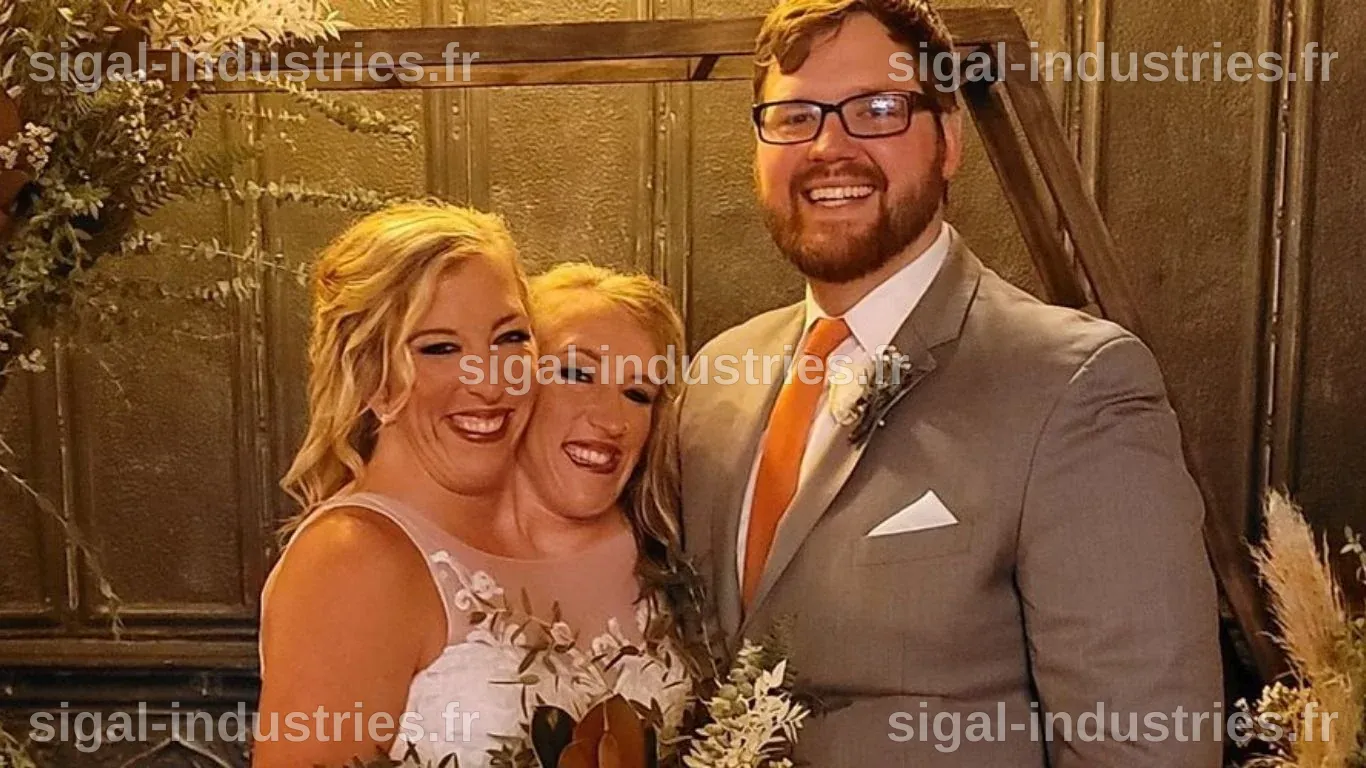 Les Sœurs Siamoises Abigail et Brittany Enceinte : Un Voyage Unique vers la Maternité
