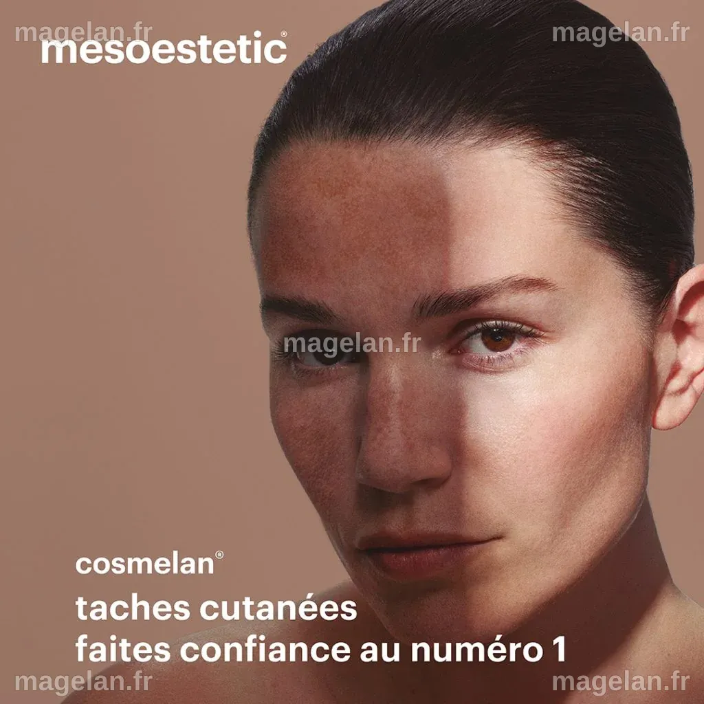 cosmelan® : leader mondial de la dépigmentation