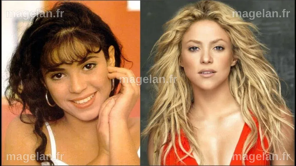 Combien de chirurgies esthétiques Shakira a-t-elle subies dans sa vie