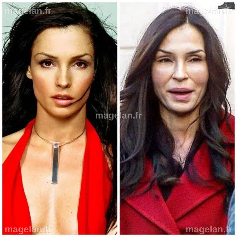 Famke Janssen Chirurgie