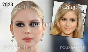 Erin Moriarty et la chirurgie esthétique | Chirurgie Esthétique du Nez ...