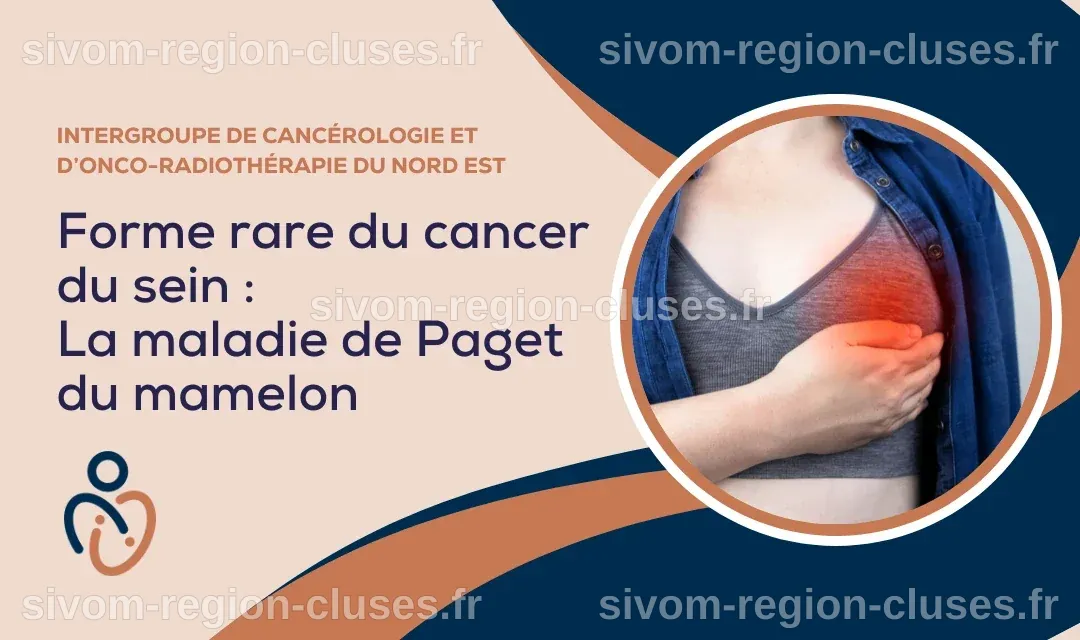 Maladie de Paget du mamelon : forme rare de cancer du sein