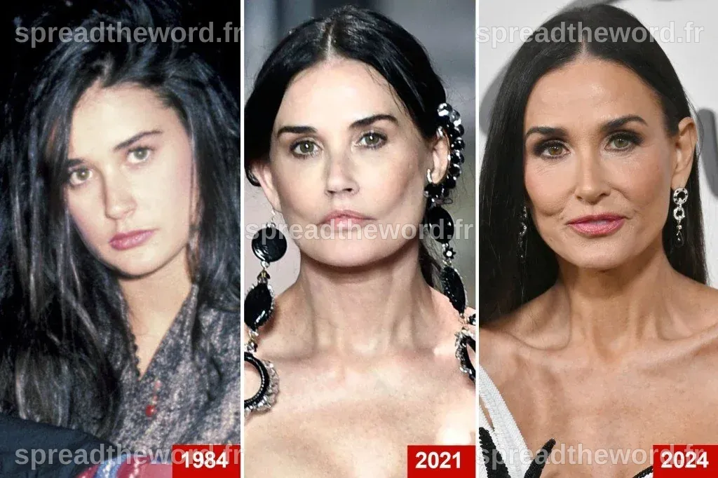 Demi Moore Plastic Surgery: All Speculations Unveiled
