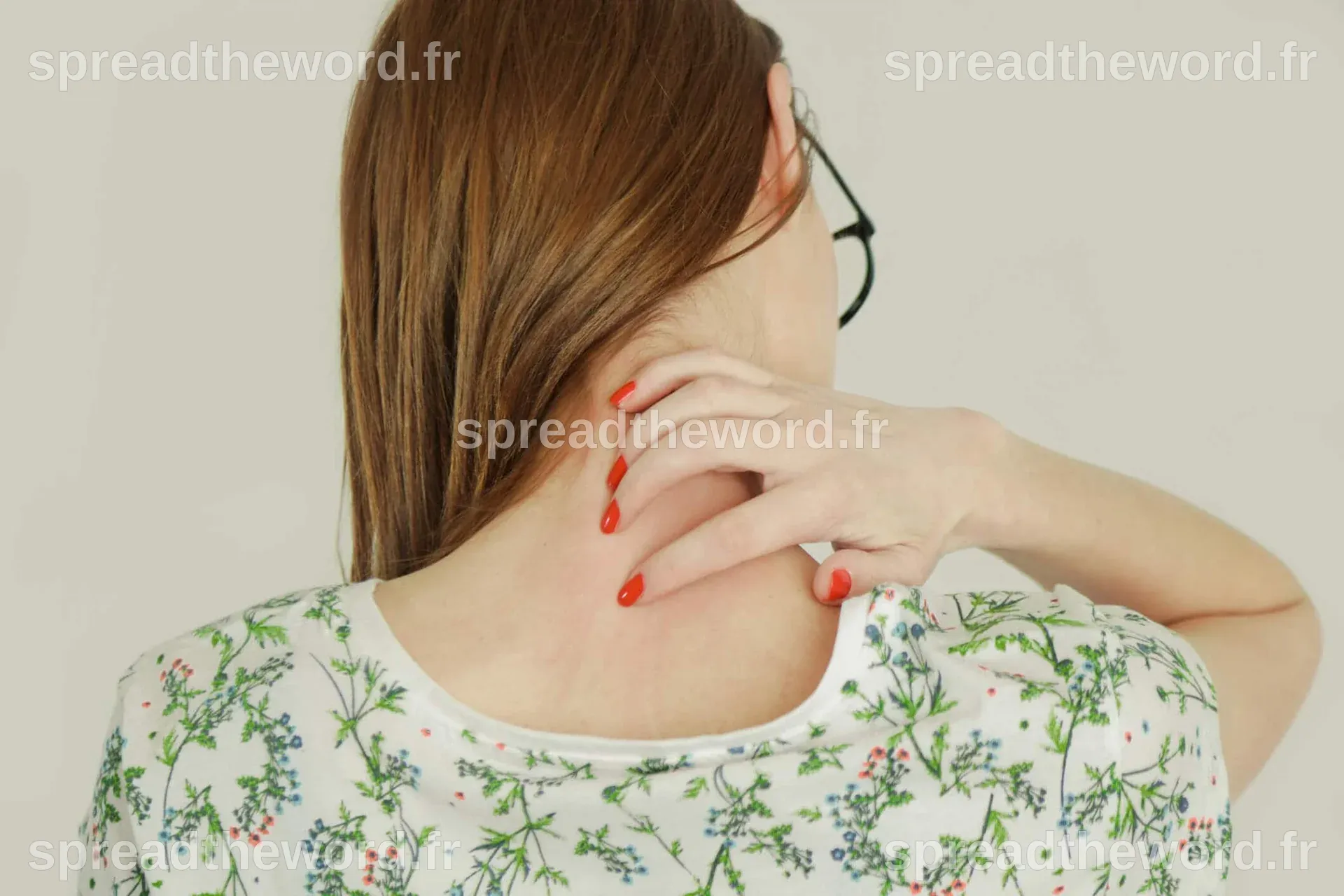 Mycose de la peau ou mycose cutanée : symptômes et traitements