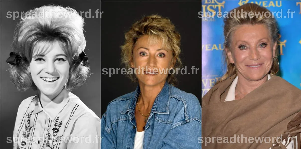 Sheila : son évolution physique en images - Femme Actuelle