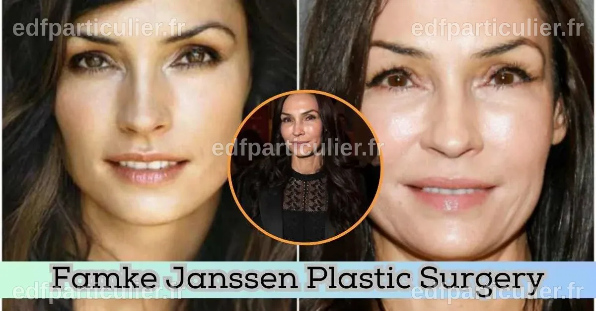 Avant chirurgie des paupières