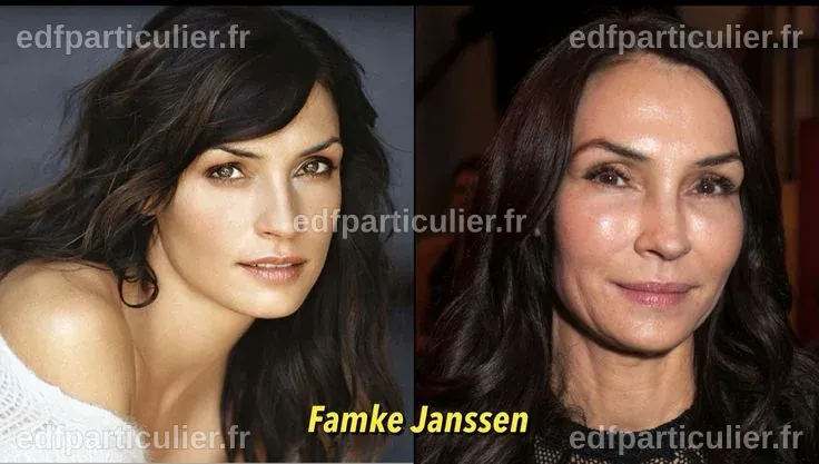 Après chirurgie de Famke Janssen
