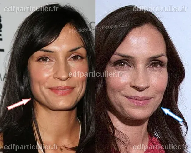 Avant chirurgie de Famke Janssen