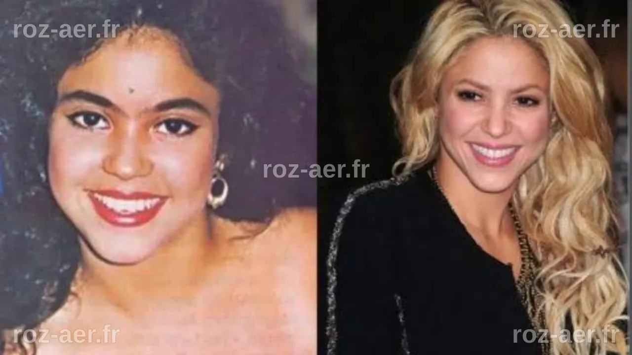 Chirurgie Esthétique de Shakira : Transformation et Évolution