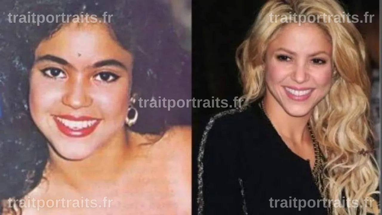 La Chirurgie Esthétique de Shakira : Évolution et Controverses