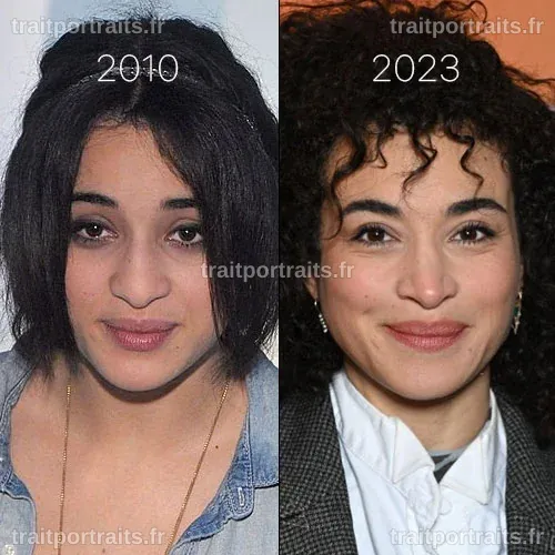 Camélia Jordana : Évolution de son nez et rumeurs de chirurgie esthétique