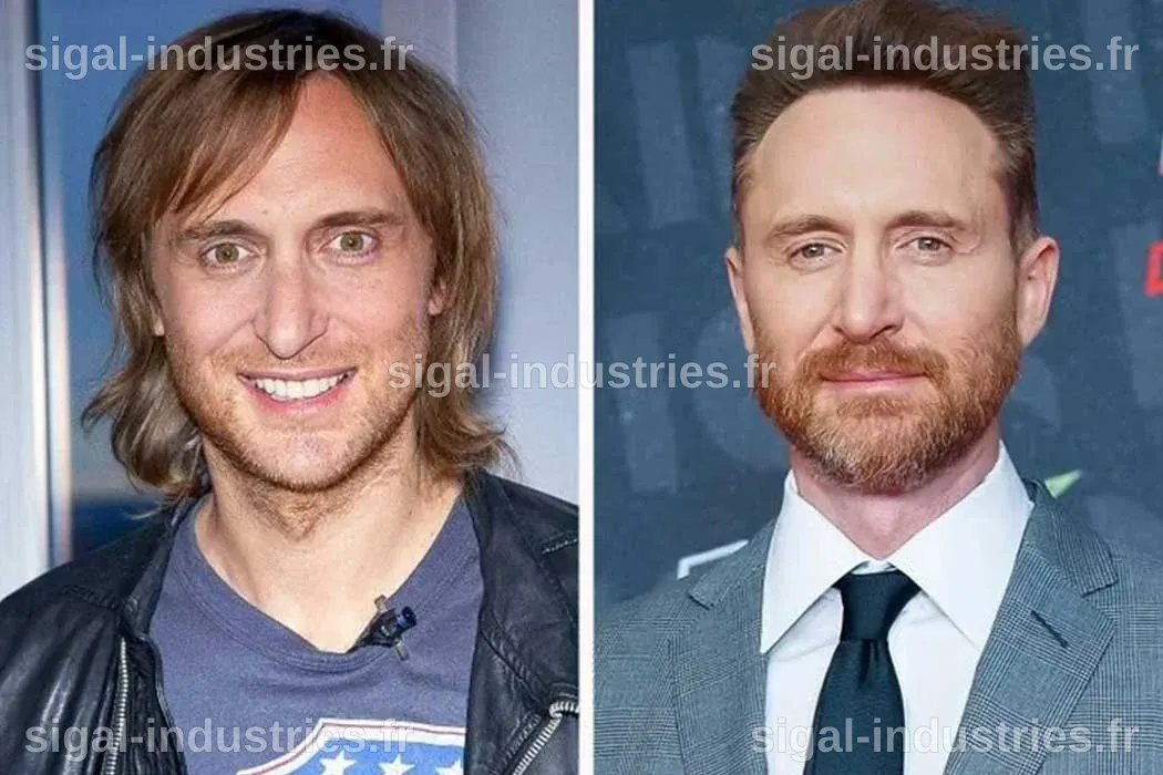 David Guetta et la Chirurgie Esthétique : Rumeurs, Réalités et Transformations