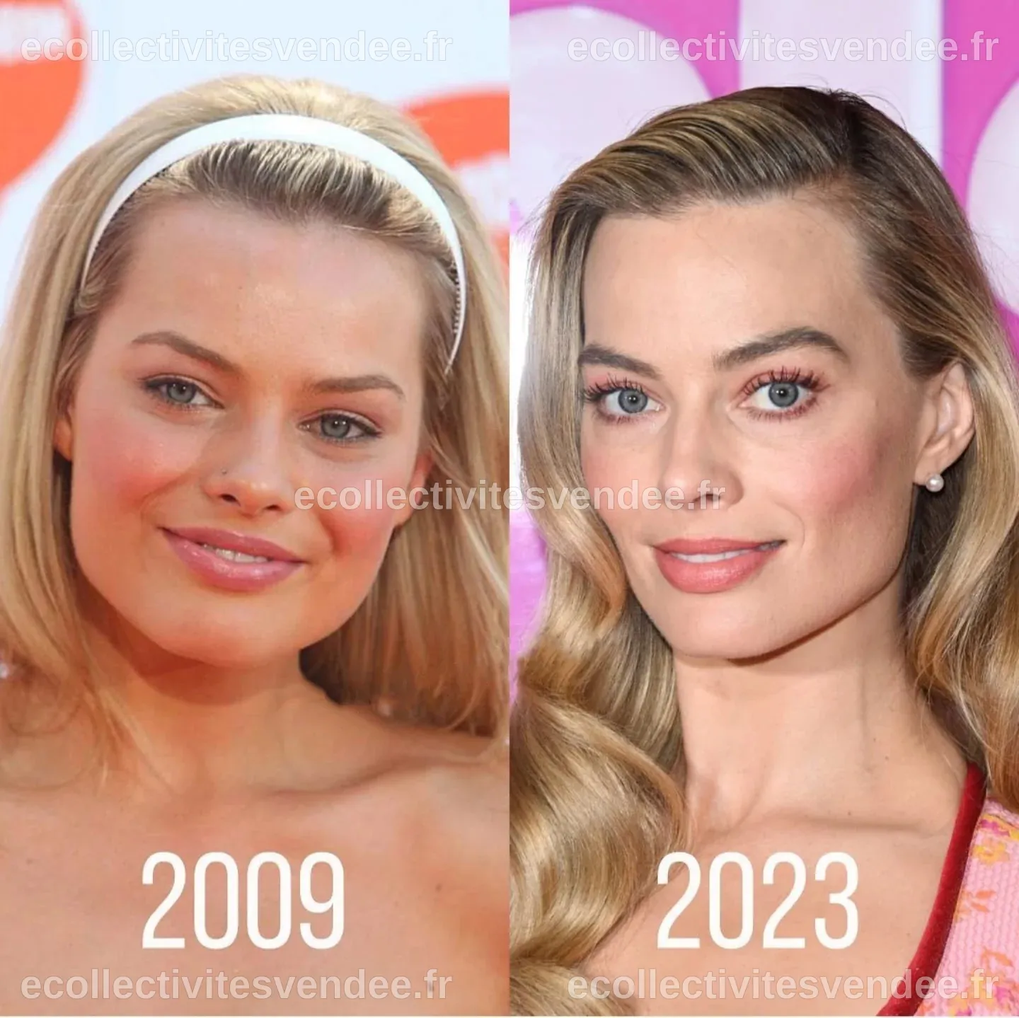 Analyse de la Chirurgie Esthétique de Margot Robbie : Transformations et Controverses
