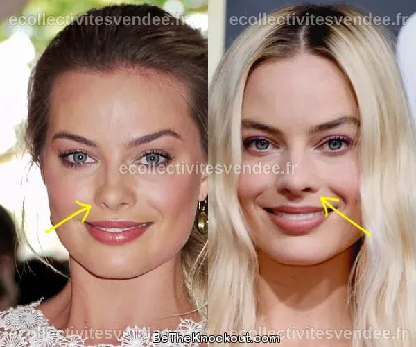 Margot Robbie Plastic Surgery Comparison Photos