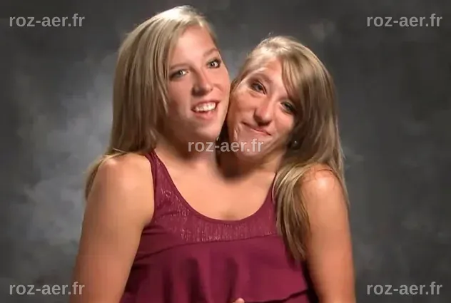 Abby et Brittany Enceinte: 