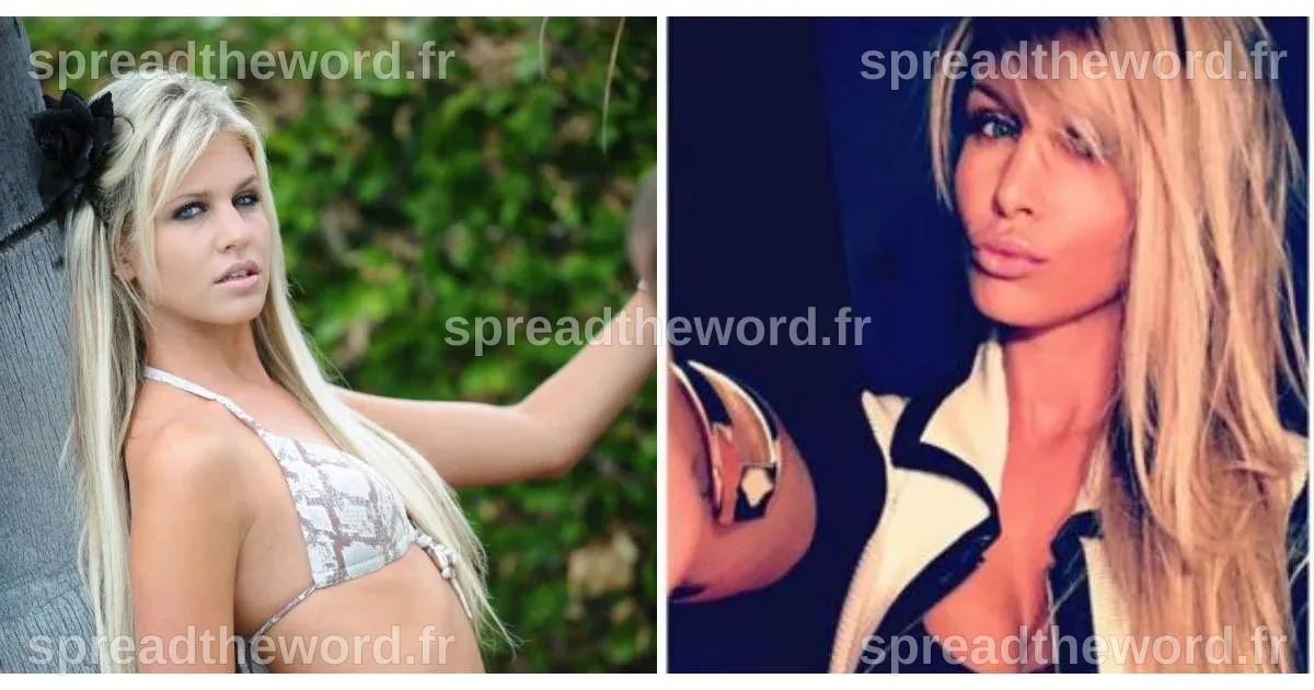 Adixia (Les Ch'tis) avant/après chirurgie : la femme de Paga ...