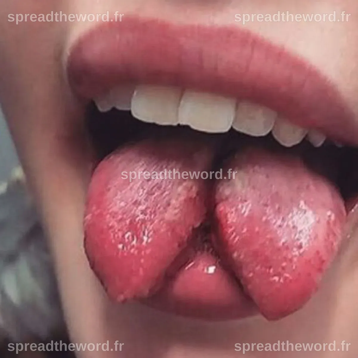 Split Tongue Splitting