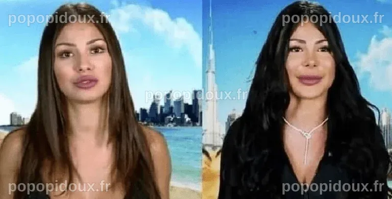 Maeva Ghennam avant la chirurgie