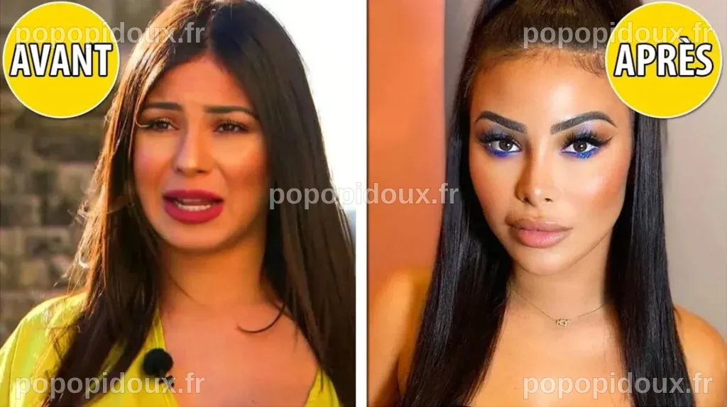 Maeva Ghennam après la chirurgie