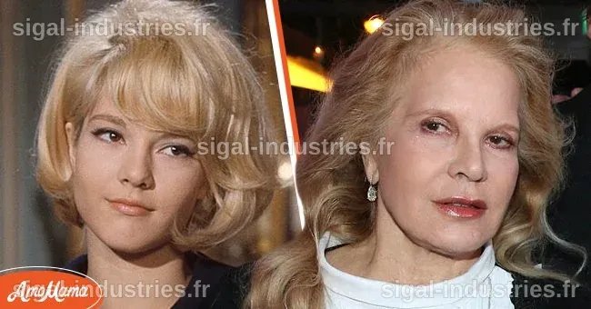 L'évolution de la chirurgie esthétique chez Sylvie Vartan : Entre beauté et controverse