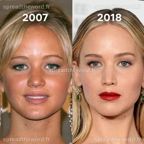Jennifer Lawrence et la chirurgie esthétique