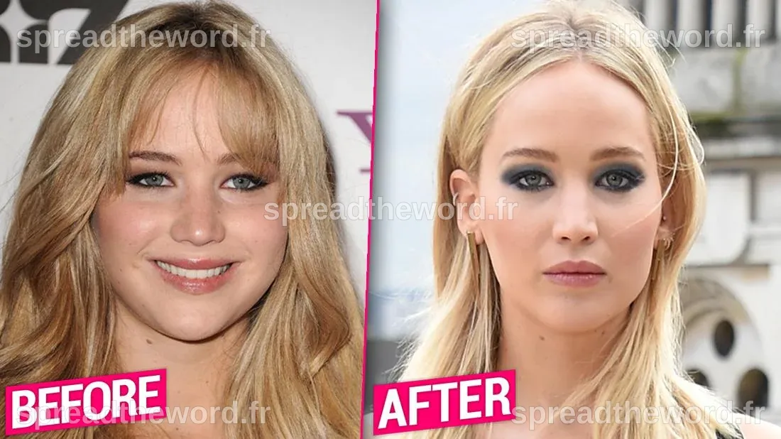 Jennifer Lawrence Before & After Plastic Surgery Makeover Exposed