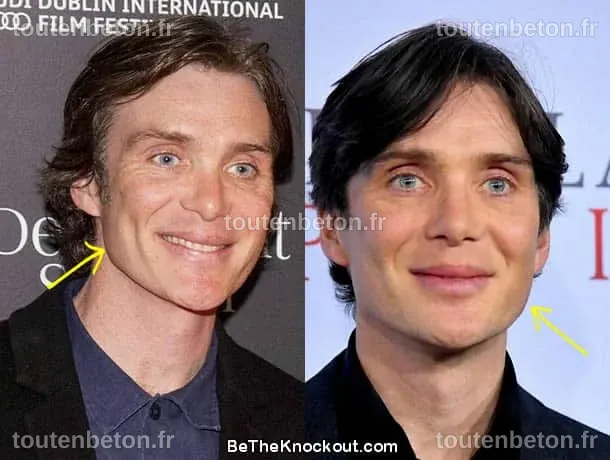 Cillian Murphy 2015