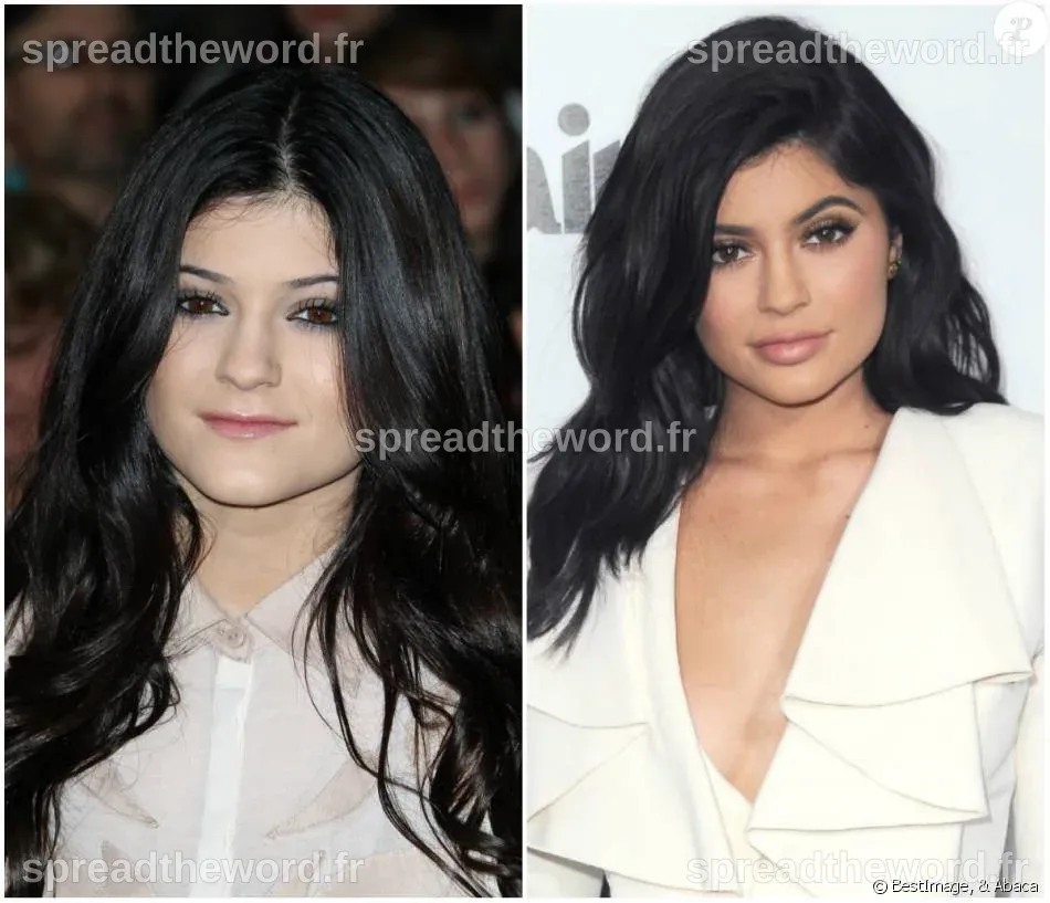 L'évolution de Kylie Jenner : Avant et Après